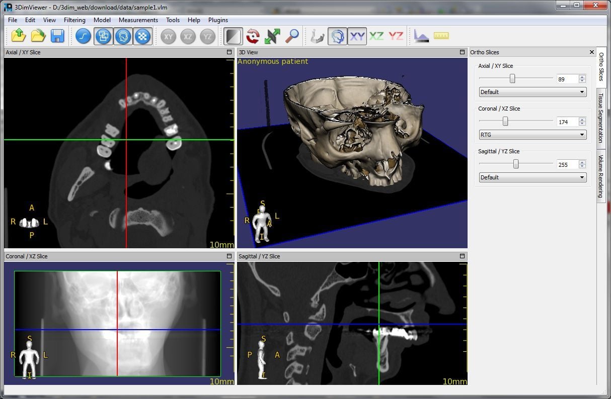 3DimViewer - Dicom Viewer presented by Medicai