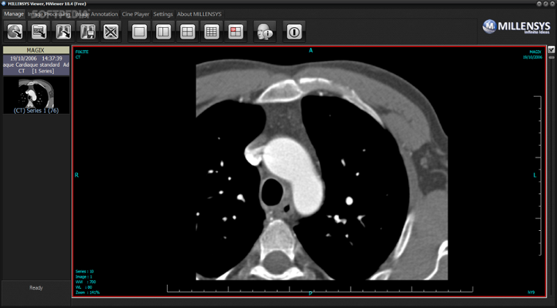 Millensys - MiViewer - Dicom Viewer presented by Medicai