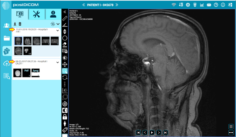 PostDICOM - Visor Dicom presentado por Medicai