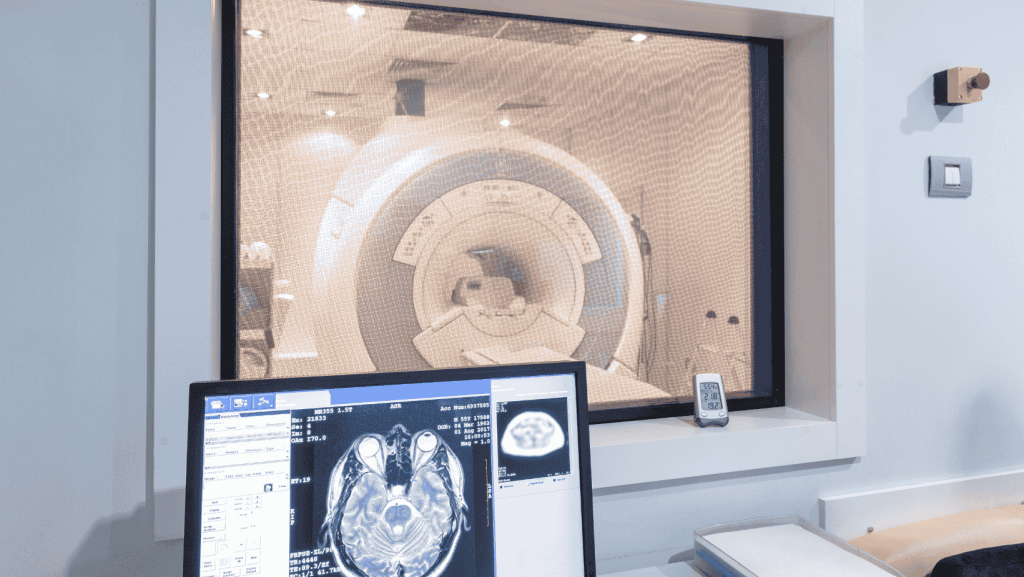 The role of imaging for patient selection for thrombectomy