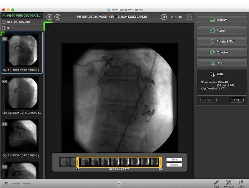 EscapeEMV - Dicom Viewer präsentiert von Medicai