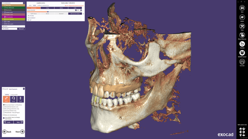Exocad - Dicom Viewer für die Zahnmedizin präsentiert von Medicai