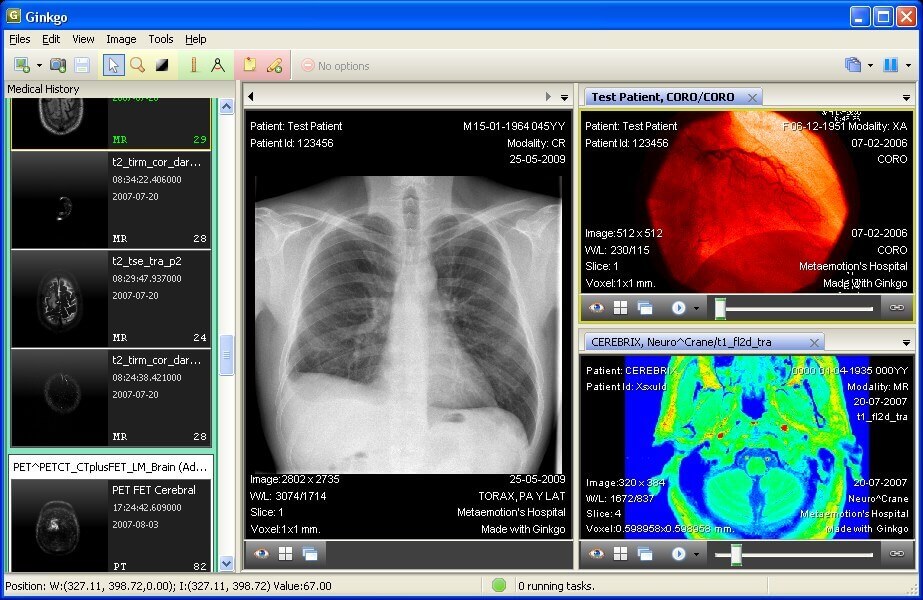Ginkgo CADx - Dicom Viewer präsentiert von Medicai