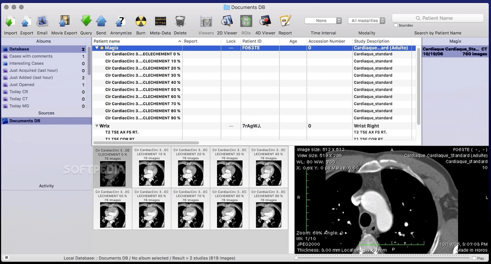Horos Dicom Viewer