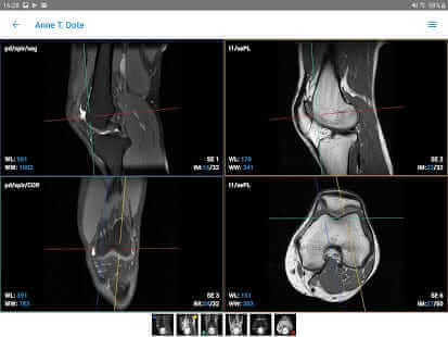 Imaios - Dicom Viewer präsentiert von Medicai
