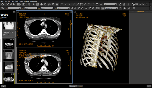 Onis 3 - Dicom Viewer präsentiert von Medicai