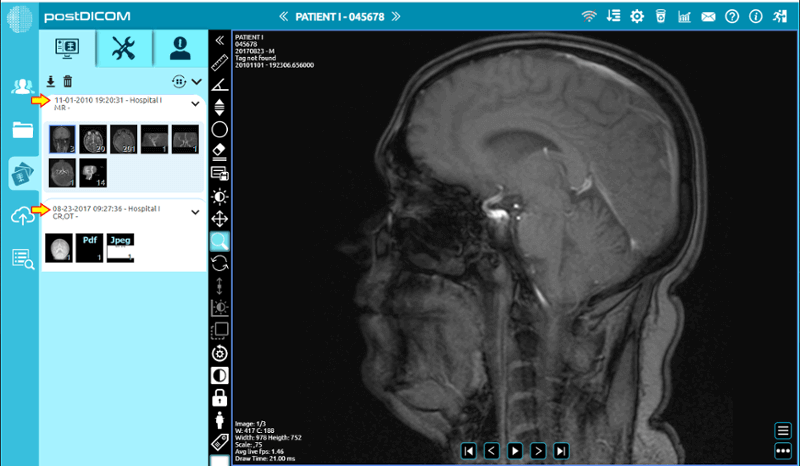 PostDICOM - Dicom Viewer präsentiert von Medicai