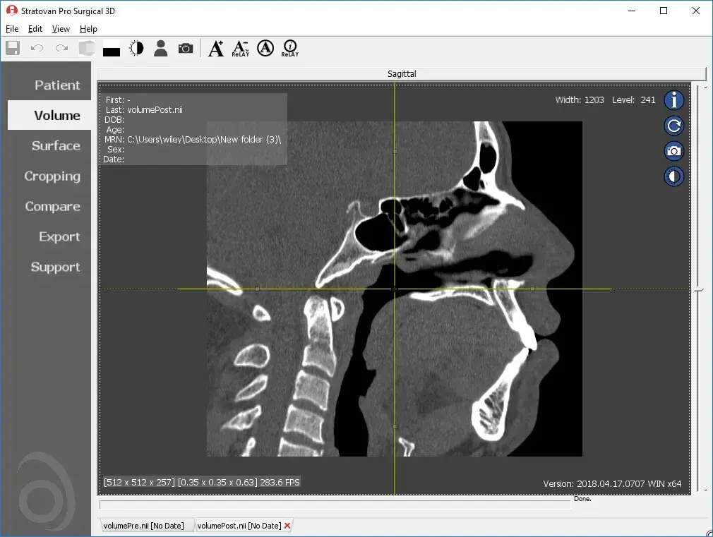 Pro Surgical 3D - Dicom Viewer präsentiert von Medicai