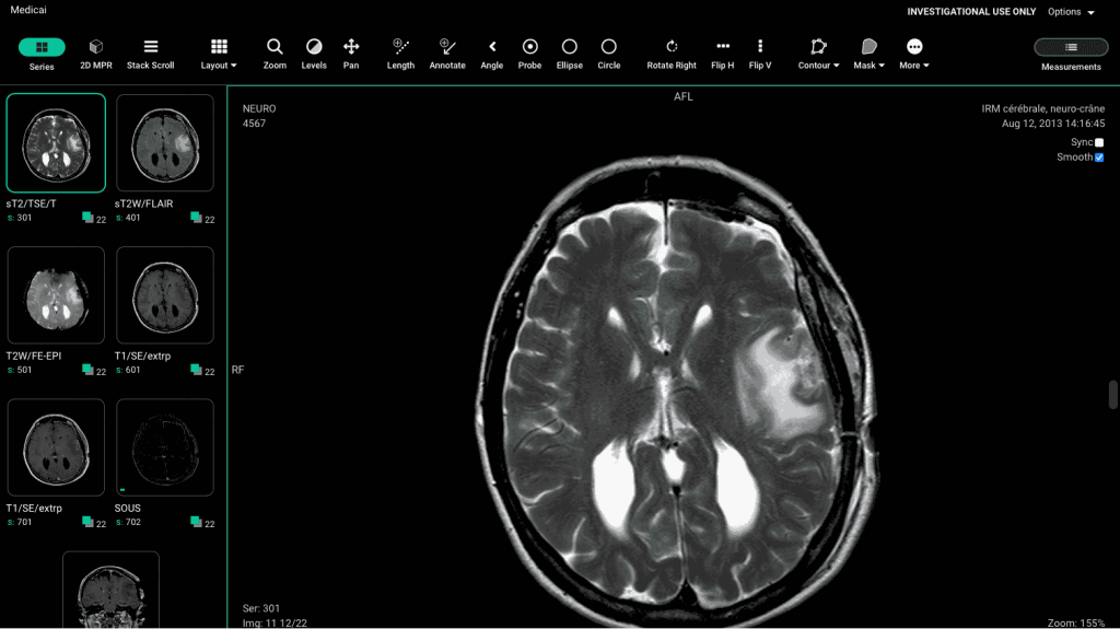 How the Future of Radiology Looks Like with Medicai’s “AI Co -Pilot”