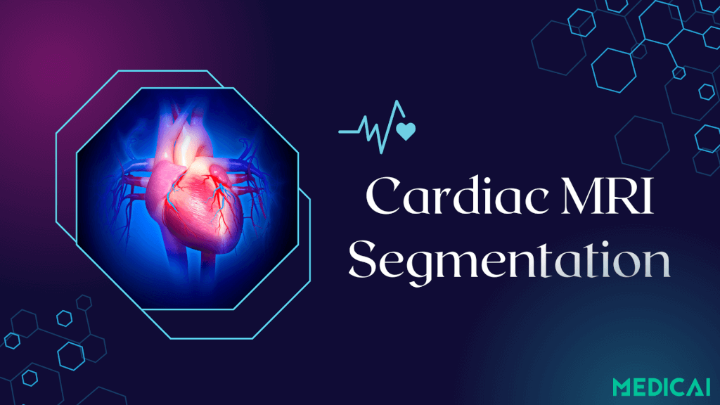 cardiac mri segmentation