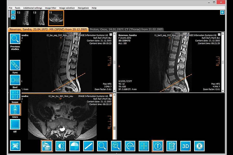 iQ-VIEW PRO - Dicom Viewer präsentiert von Medicai