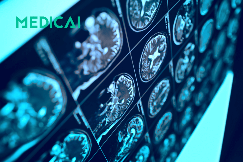 which is better mri or ct scan for brain