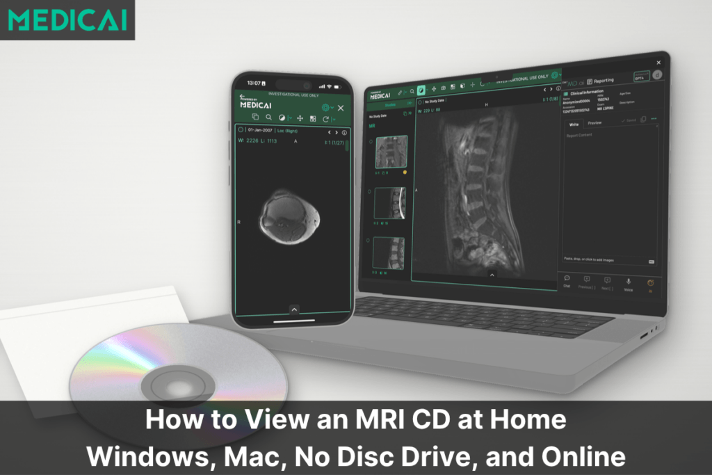 How to View an MRI CD at Home: Windows, Mac, No Disc Drive, and Online